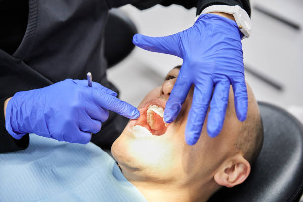 Best Dentist for Tooth Abscess  in Cedaredge, CO